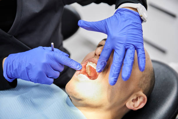 Best Emergency Treatment for Oral Infections in Avila Beach, CA